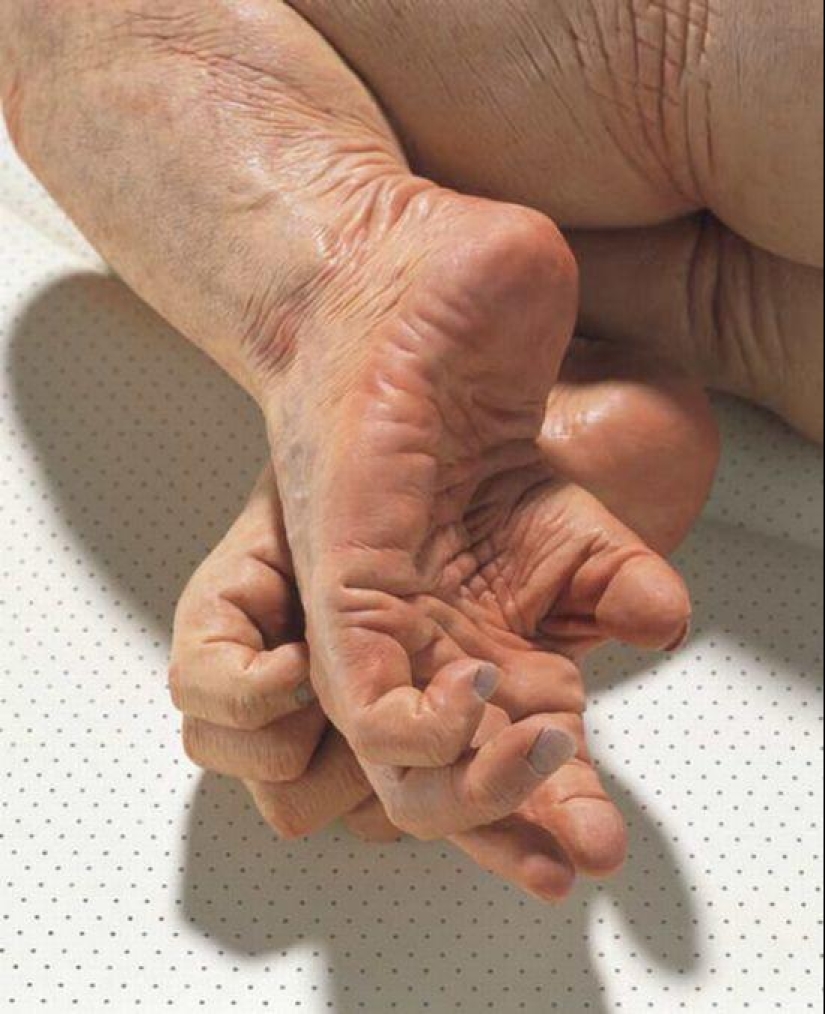 Gentle Monsters by Patricia Piccinini