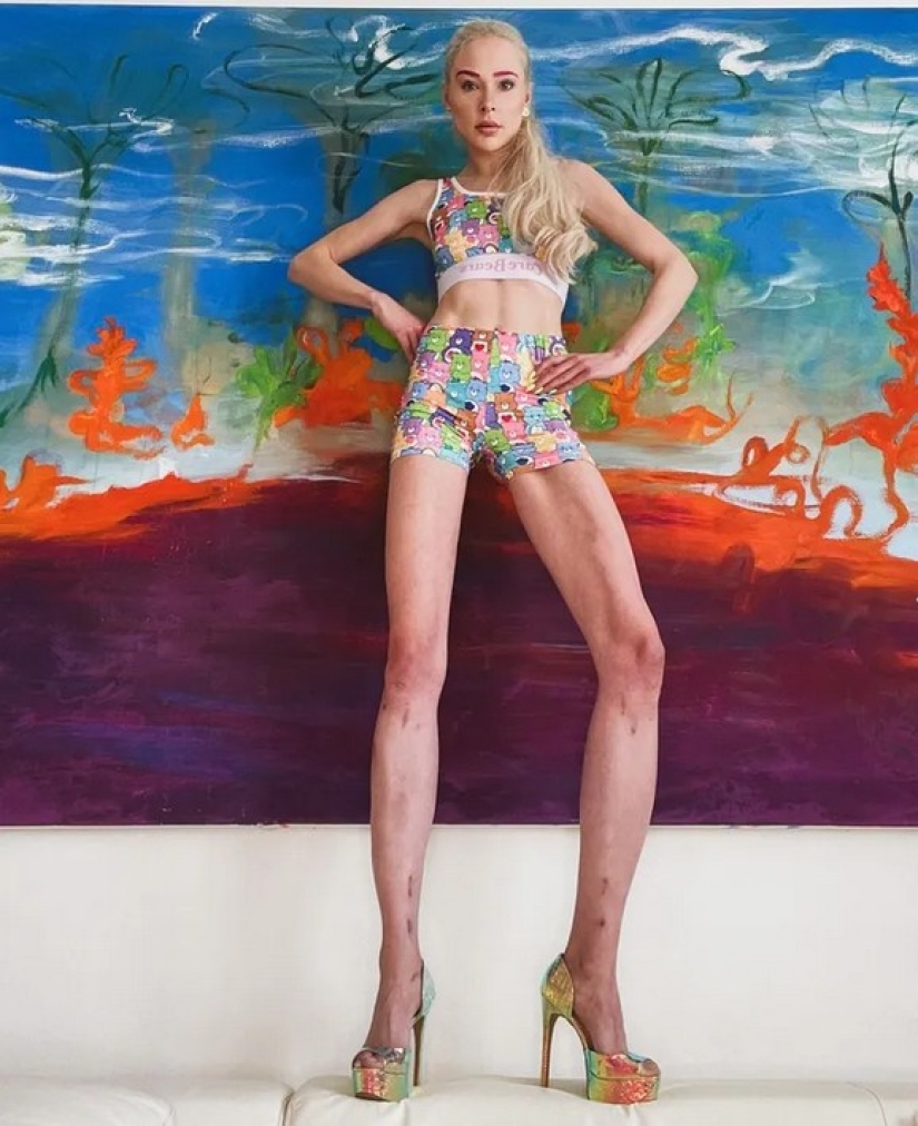 German model lengthened her legs by 14 cm and is not going to stop