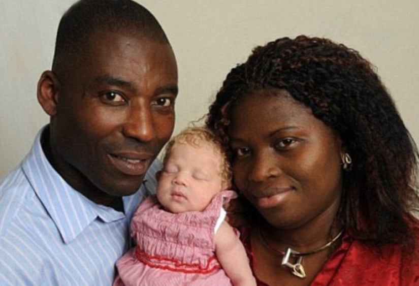 Hace 11 años, nació un "ángel blanco" de una pareja nigeriana. Que belleza se ha vuelto la chica con los años