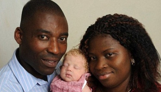 Hace 11 años, nació un "ángel blanco" de una pareja nigeriana. Que belleza se ha vuelto la chica con los años