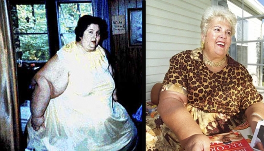 How fat Rosalie Bradford got into the Guinness Book of Records twice