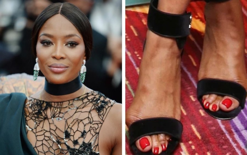 Imperfect from head to toe: 11 beauties in which at least one flaw is hidden