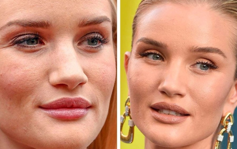 Imperfect from head to toe: 11 beauties in which at least one flaw is hidden