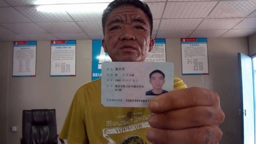 In 10 years, a Chinese youth turned into an old man