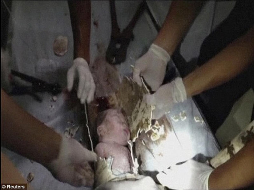 In China, a newborn was rescued after being flushed down the toilet