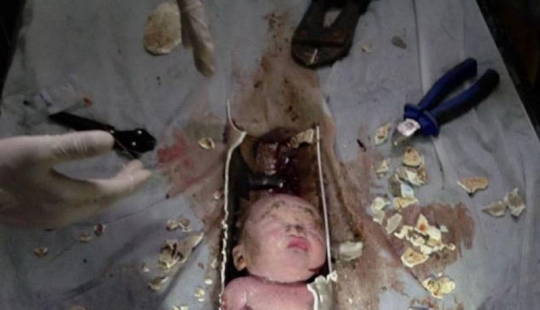 In China, a newborn was rescued after being flushed down the toilet