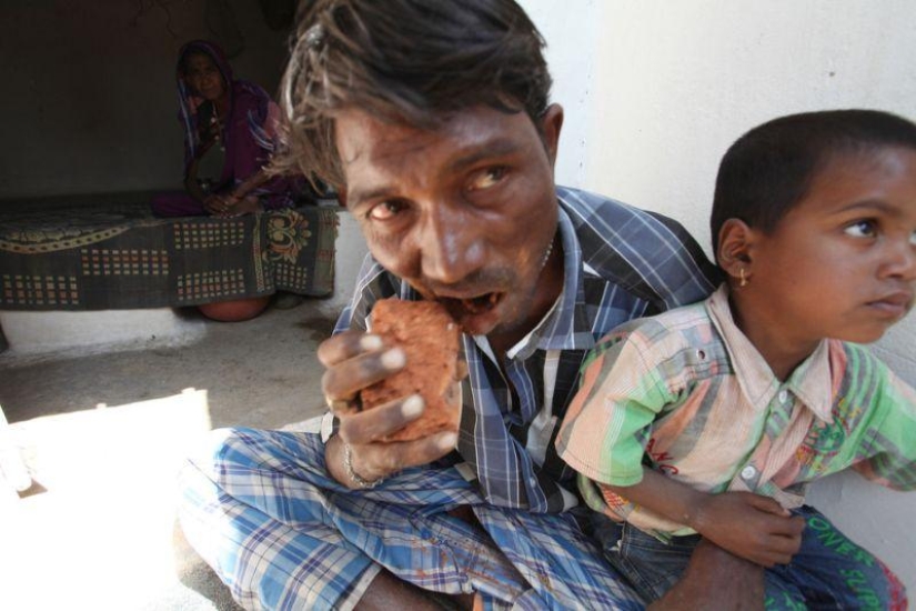 Indian man eats bricks and stones for 20 years
