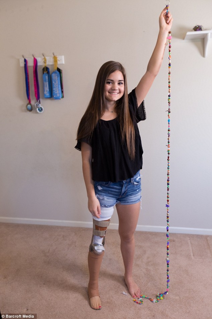 Inspiring example: a girl with a prosthetic leg became a wonderful dancer