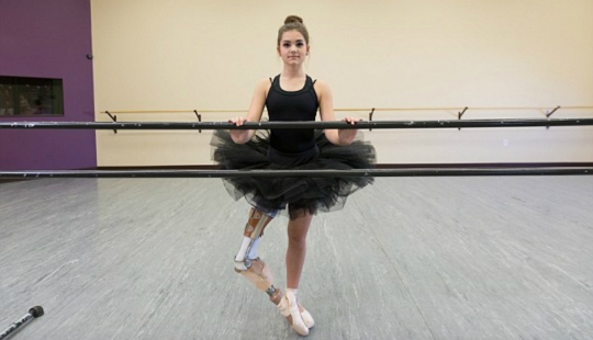 Inspiring example: a girl with a prosthetic leg became a wonderful dancer