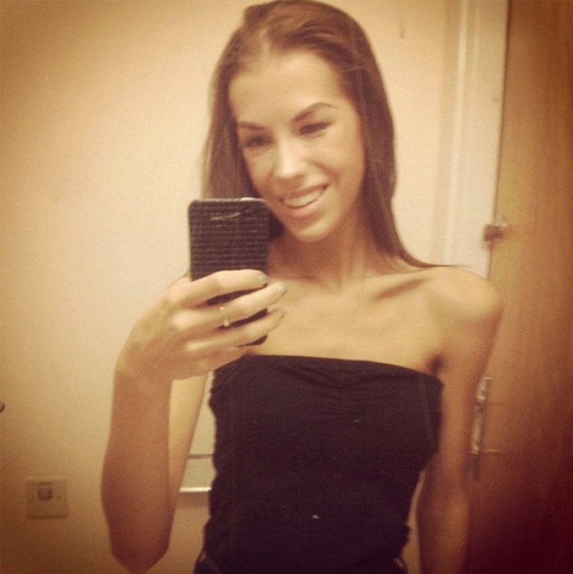 Instagram de la semana: Victoria sobre la anorexia