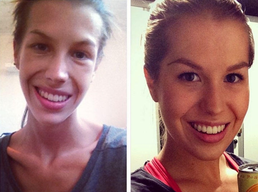 Instagram of the week: Victory over anorexia