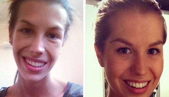 Instagram of the week: Victory over anorexia