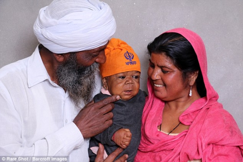 La inexplicable historia de un indio de 21 años que se quedó atrapado en el cuerpo de un bebé