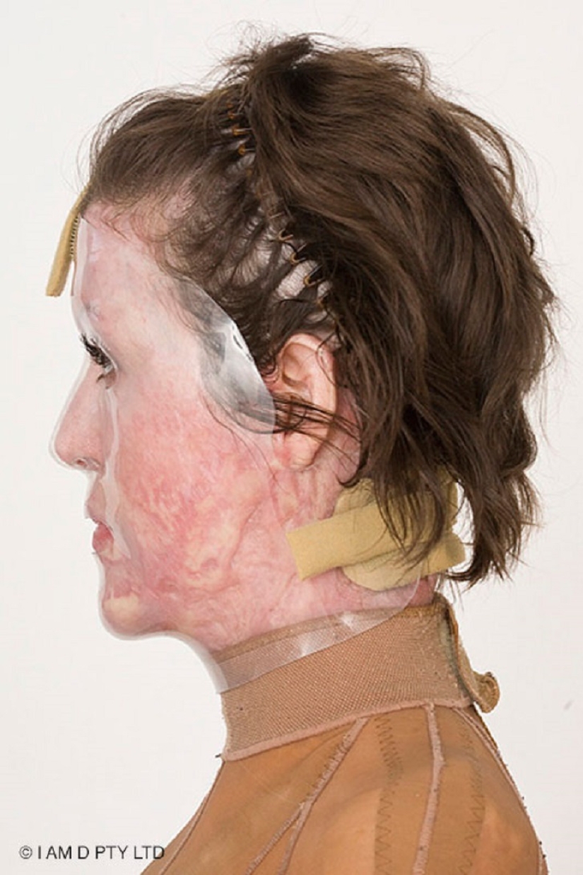 La mujer australiana que alguna vez estuvo a punto de quemarse viva finalmente se quitó la máscara