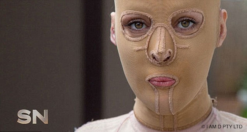 La mujer australiana que alguna vez estuvo a punto de quemarse viva finalmente se quitó la máscara