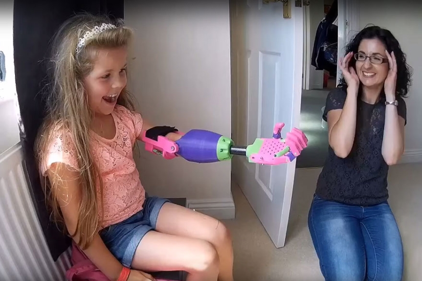 La niña recibió una prótesis 3D de un diseñador que tampoco tiene brazo