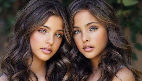 Las gemelas más bellas del mundo: su vida muchos años después de ganar fama y fama