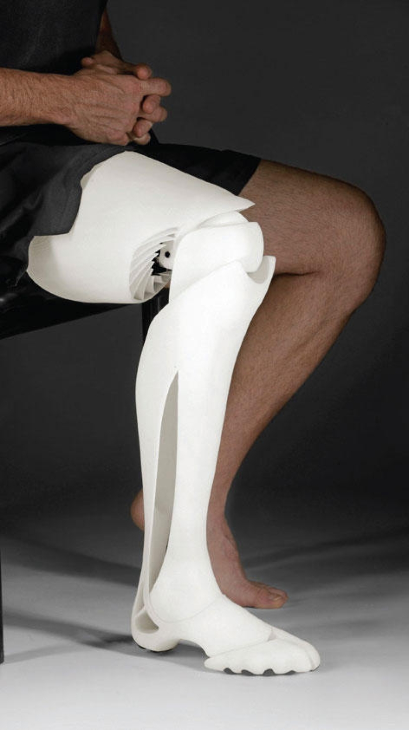 ¡Las prótesis también pueden ser elegantes y con estilo!