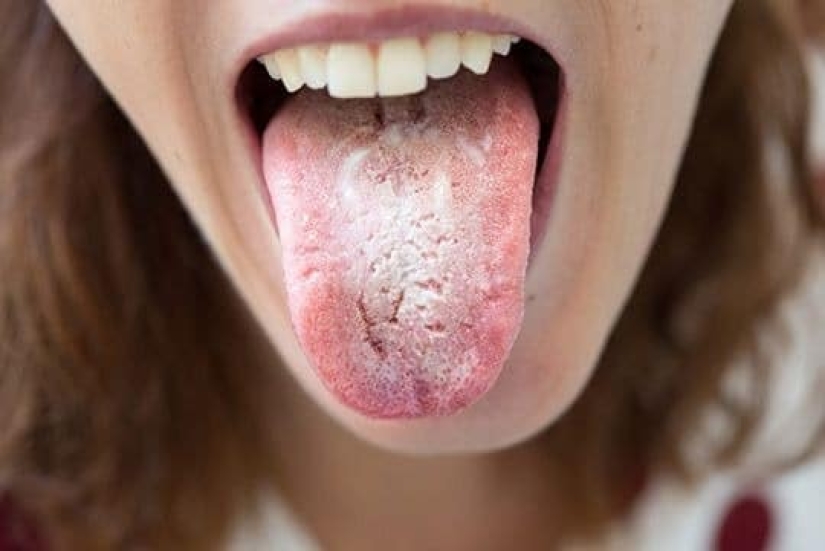 Leer tus dientes! 5 signos de enfermedades que se pueden encontrar en la boca