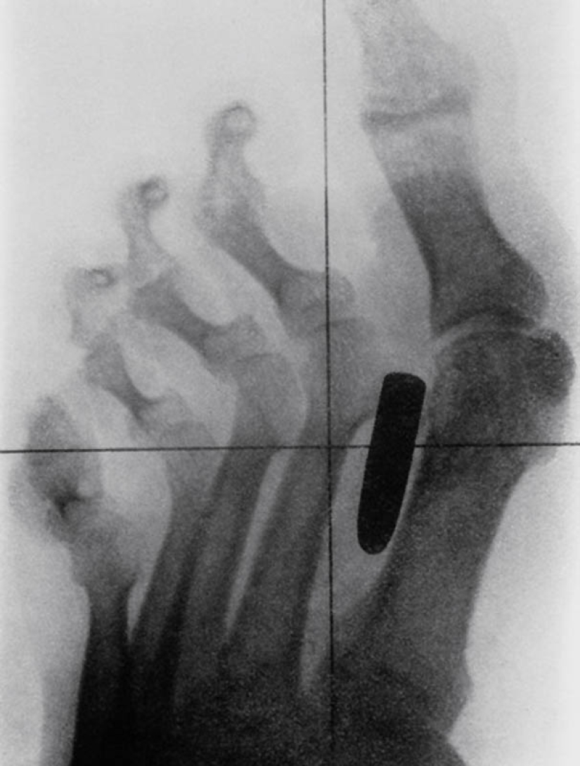 Los rayos X más extraños