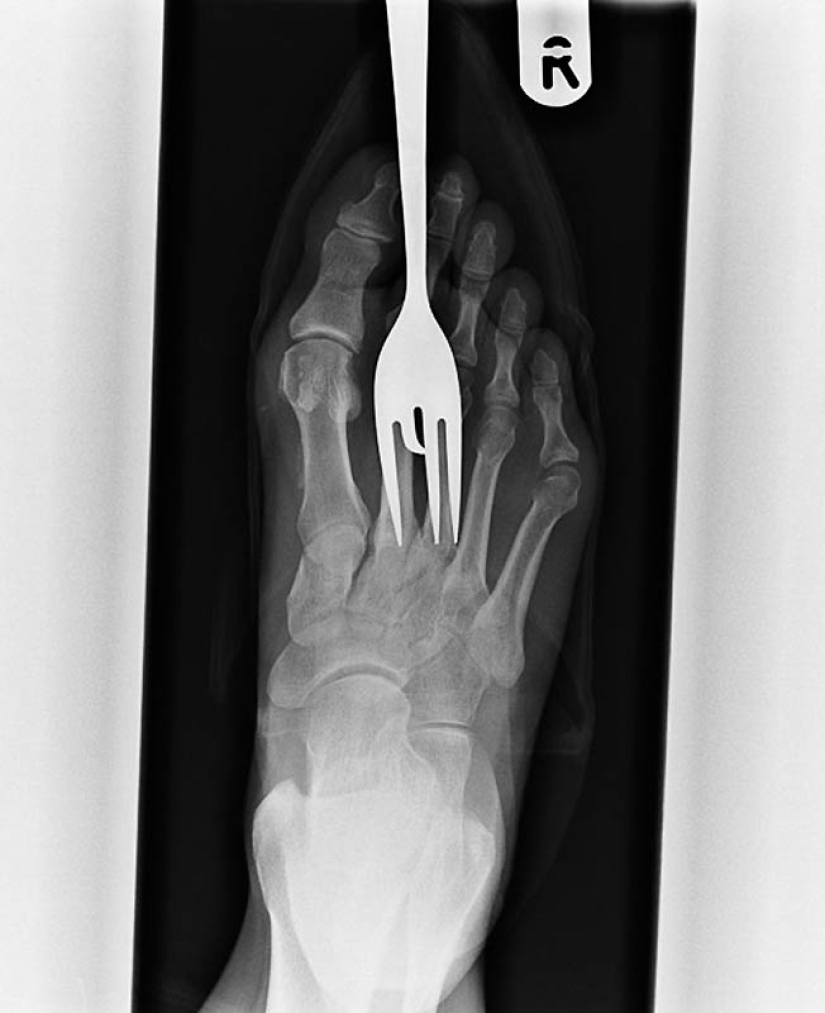 Los rayos X más extraños