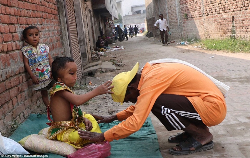 Los residentes de una aldea india adoran a un niño con la cabeza deformada como el dios Ganesha