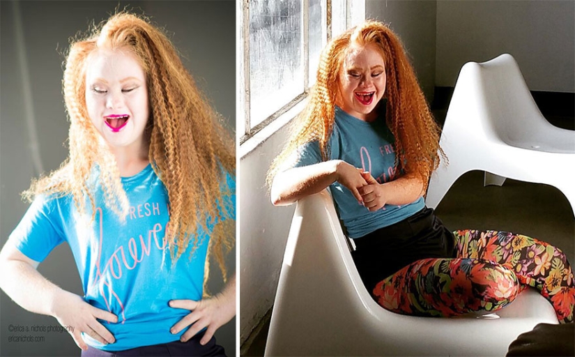 Model with Down syndrome: &quot;We can be beautiful and sexy&quot;