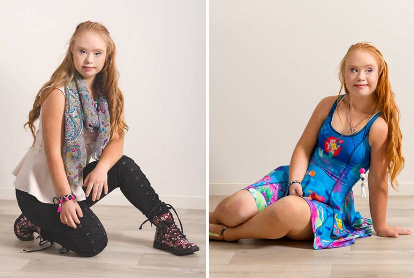 Model with Down syndrome: &quot;We can be beautiful and sexy&quot;