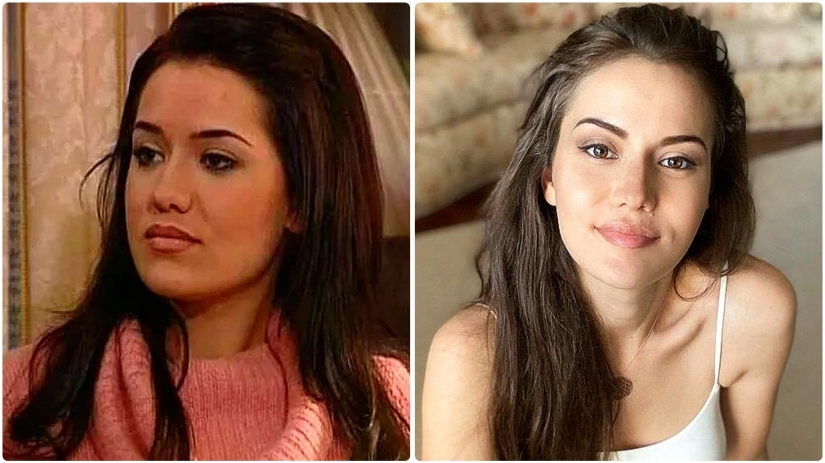 More than 14 operations were performed by the wife of Burak Ozchivit - what did she look like before aesthetics?