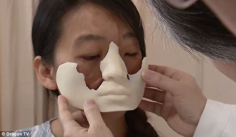 Mujer china con cara deformada los médicos le hacen crecer una nueva cara en el pecho
