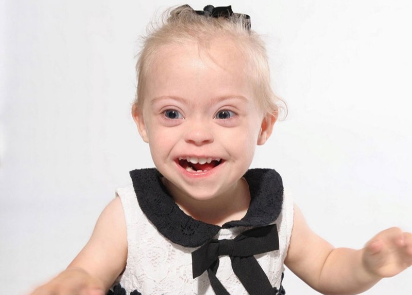 Niña de dos años con síndrome de Down se convirtió en modelo gracias a su radiante sonrisa