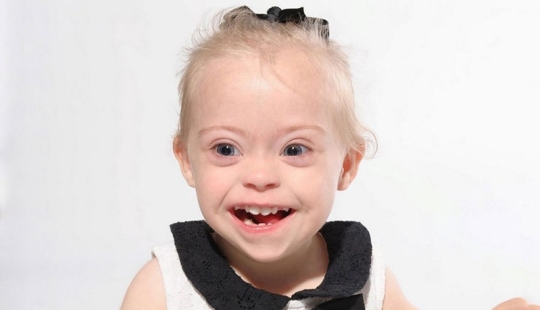 Niña de dos años con síndrome de Down se convirtió en modelo gracias a su radiante sonrisa