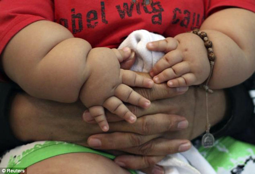 Obese 8-month-old baby seized from parents