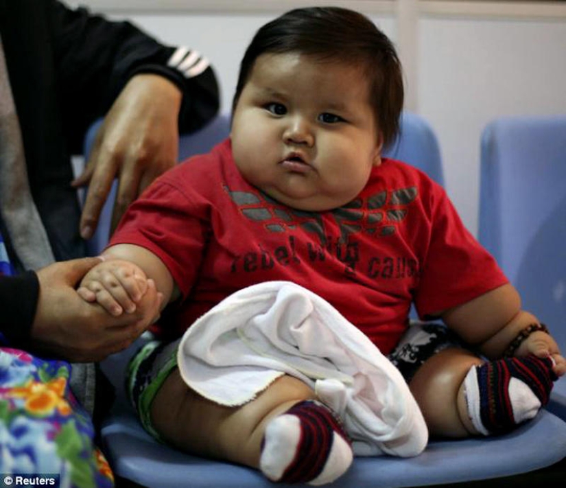 Obese 8-month-old baby seized from parents