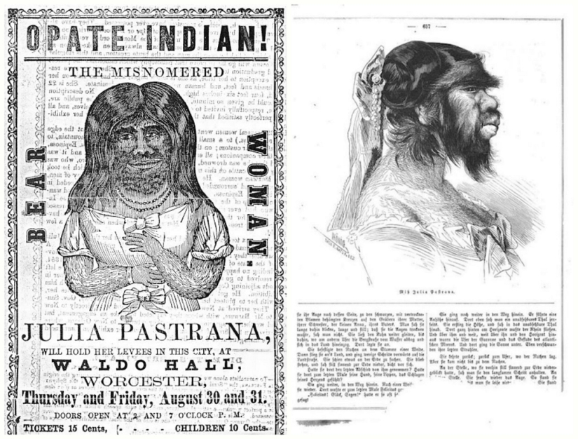 On the face of the terrible, kind inside: the life and death of bearded Julia, the ape woman from Mexico