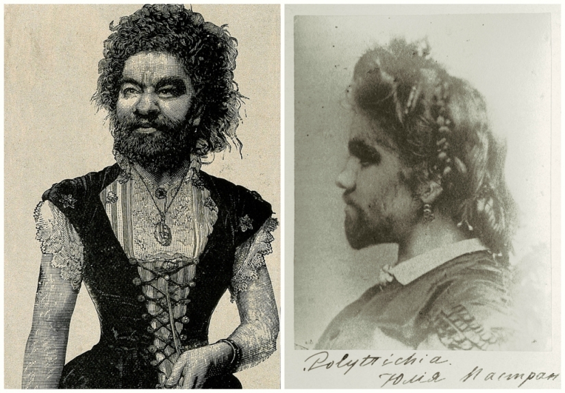 On the face of the terrible, kind inside: the life and death of bearded Julia, the ape woman from Mexico