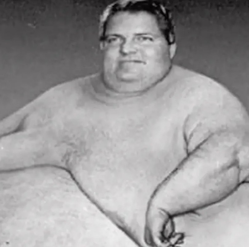 “Overweight by 590 kg”: lay on the couch all day and ate 10 kg of food a day to become the fattest in the world. What did he look like?