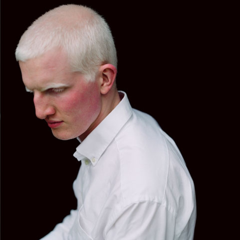 Paola de Grene's Albinos