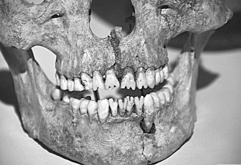 Pasta de dientes de los antiguos romanos: detalles repugnantes de la historia de la higiene bucal
