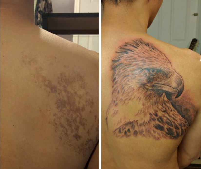 Personas con marcas de nacimiento que no se confundieron y las hicieron parte de los tatuajes