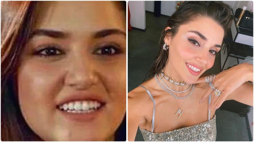 Photo before plastic surgery: the woman of the year did 10 operations and her relatives do not recognize her