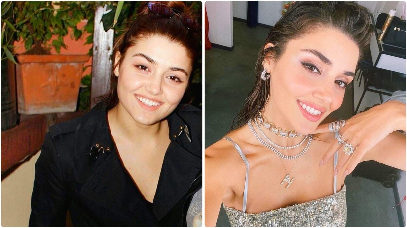 Photo before plastic surgery: the woman of the year did 10 operations and her relatives do not recognize her