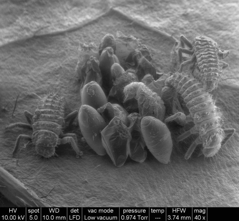 Photos taken with an electron microscope
