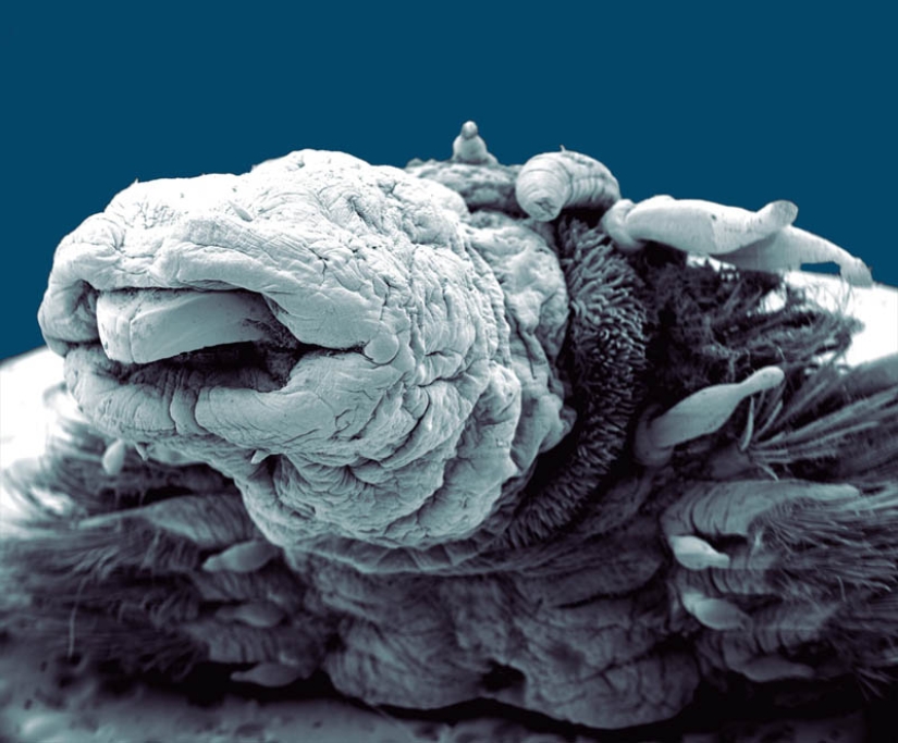 Photos taken with an electron microscope