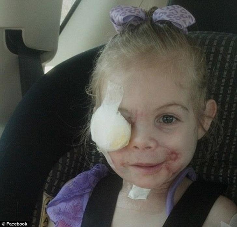 Pit bull mutilated 3-year-old girl kicked out of diner because of her appearance