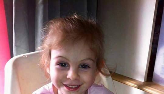 Pitbull mutiló a niña de 3 años y la echaron de restaurante por su apariencia Pitbull mutiló a niña de 3 años y la echaron de restaurante por su apariencia