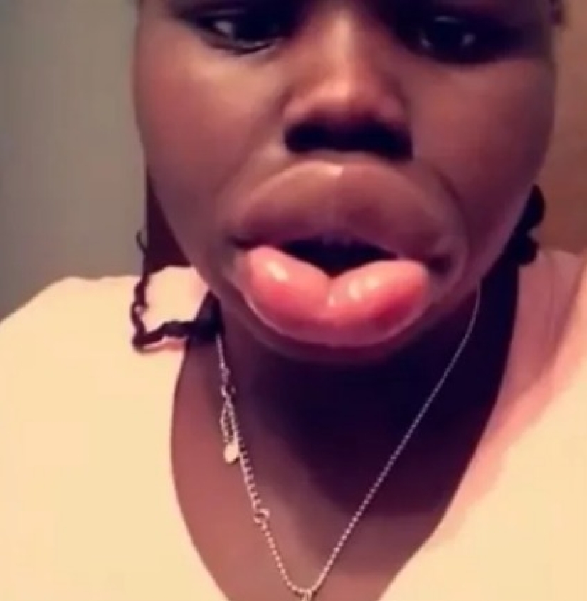 ¿Por qué los negros tienen los labios tan grandes? te explico de forma sencilla