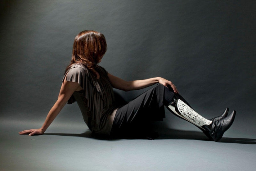 Prostheses can also be elegant and stylish!