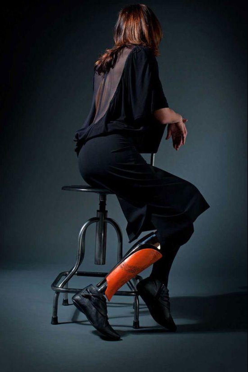 Prostheses can also be elegant and stylish!