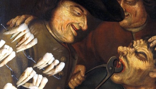 ¿Qué es el "Waterloo dientes", o Como la batalla de 1815 influido en el desarrollo de la odontología